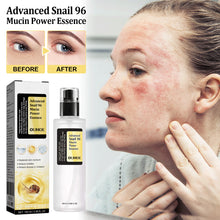 96% Snail Mucin Serum for Sensitive Skin – Hydrating, Repairing & Whitening
