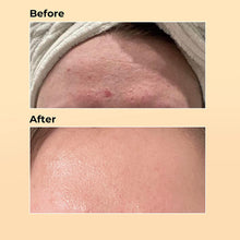 96% Snail Mucin Serum for Sensitive Skin – Hydrating, Repairing & Whitening